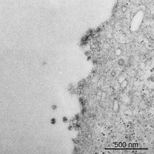 Unizar obtiene imágenes microscópicas del primer coronavirus aislado en Aragón